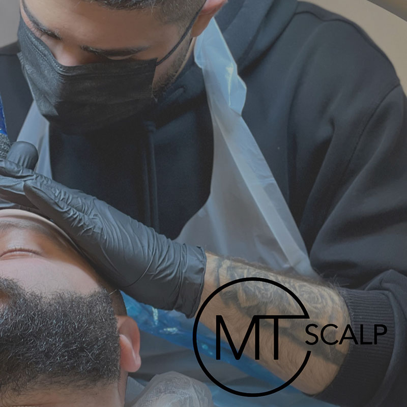 A co worker at MT does the MT Scalp treatment on a young male